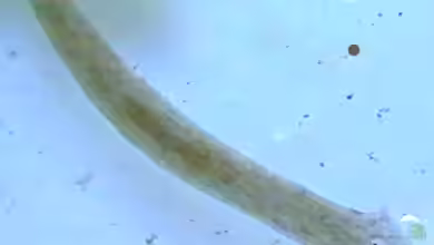 Planarien, Hydras und Grindalwürmer, ungeliebte Plagegeister.