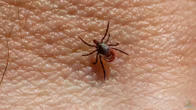 Zecken im Garten: Was gegen sie hilft