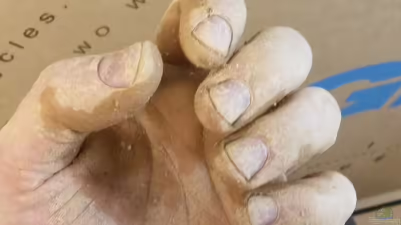 Fingerpeeling von Beulenkopftyp (19)